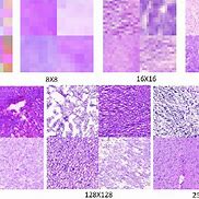 Image result for Generative Adversarial Networks Medical