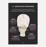 Image result for Subluxación Vertebral