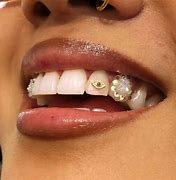 Image result for Dental Jewelry Teeth