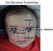 Image result for Conjugate Eye Movement