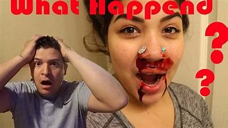 Image result for Lip Piercing Gone Wrong