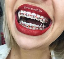 Image result for Dental Jewelry Teeth