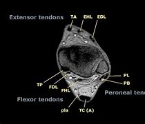 Image result for Tendons in Ankle