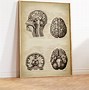 Image result for Mental Health Brain Poster