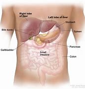 Image result for Liver Cancer Real Photo