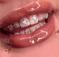 Image result for Teeth Accessories