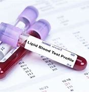 Image result for Lipid Blood Test