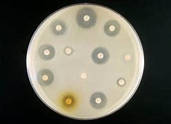 Image result for Antibiotic Resistance Chart