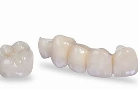 Image result for Zirconia Crown