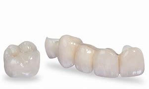 Image result for Zirconia Crown Tooth