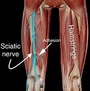 Image result for Hamstring Muscle Pain