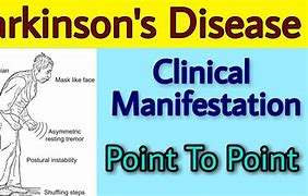 Image result for Parkinson's Disease Signs and Symptoms