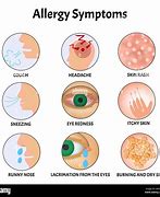 Image result for Itchy Eyes Allergies