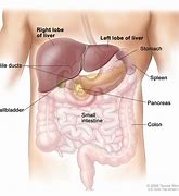 Image result for Liver Cancer Lump Under Rib Cage