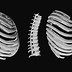 Image result for Flat Rib Cage