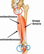 Image result for Tendinopathy Hamstring Knee