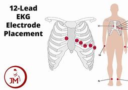 Image result for ECG Strip 12 Lead Template