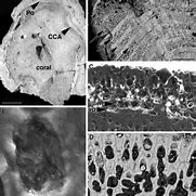 Image result for Intracellular Calcium