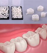 Image result for Teeth Accessories