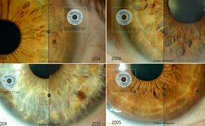 Image result for The Eye Iridology Reading Chart