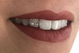 Image result for Dental Jewelry Teeth