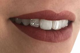 Image result for Dental Jewelry Teeth