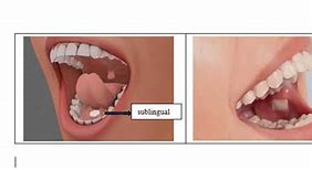 Image result for Sublingual Administration