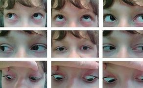 Image result for NLP Eye Movement Chart