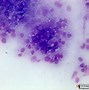 Image result for Leishmania