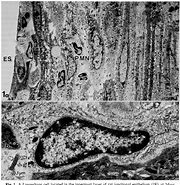 Image result for Langerhans Cells Function