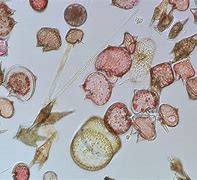 Image result for Protist Plant