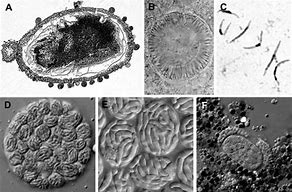 Image result for Pictures of Apicomplexans