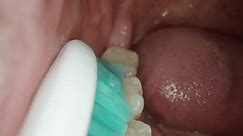 Clear Example of How a Man Brushes His Teeth, Filmed Inside the Mouth with a View of the Lower Jaw.