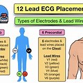 12 Lead EKG Electrode Placement