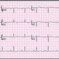 12 Lead EKG High Quality