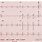 12 Lead EKG Paper