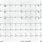 Normal 12 Lead EKG Strip