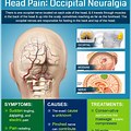 Occipital Neuralgia Headache