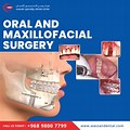 Oral and Maxillofacial Surgery Right Side