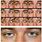 Abnormal Eye Movements