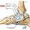 Ankle Anatomy Deltoid Ligament