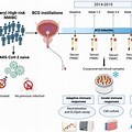 BCG Bladder Cancer