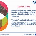 Blind Spot Vision