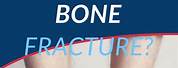 Cuboid Bone Fracture Treatment