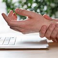 Carpal Tunnel Syndrome Workers-Compensation