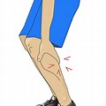 Clip Art Leg Cramps