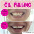 Coconut Oil Teeth Pulling