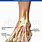 Extensor Tendonitis in Foot