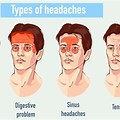 Front Head Headache