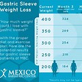 Gastric Sleeve Surgery Weight Loss Chart